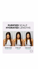 L’Oréal Paris Elvive Hydra Pure Exfoliating Pre-Shampoo Scalp Serum for Oily Scalp & Roots 102ml