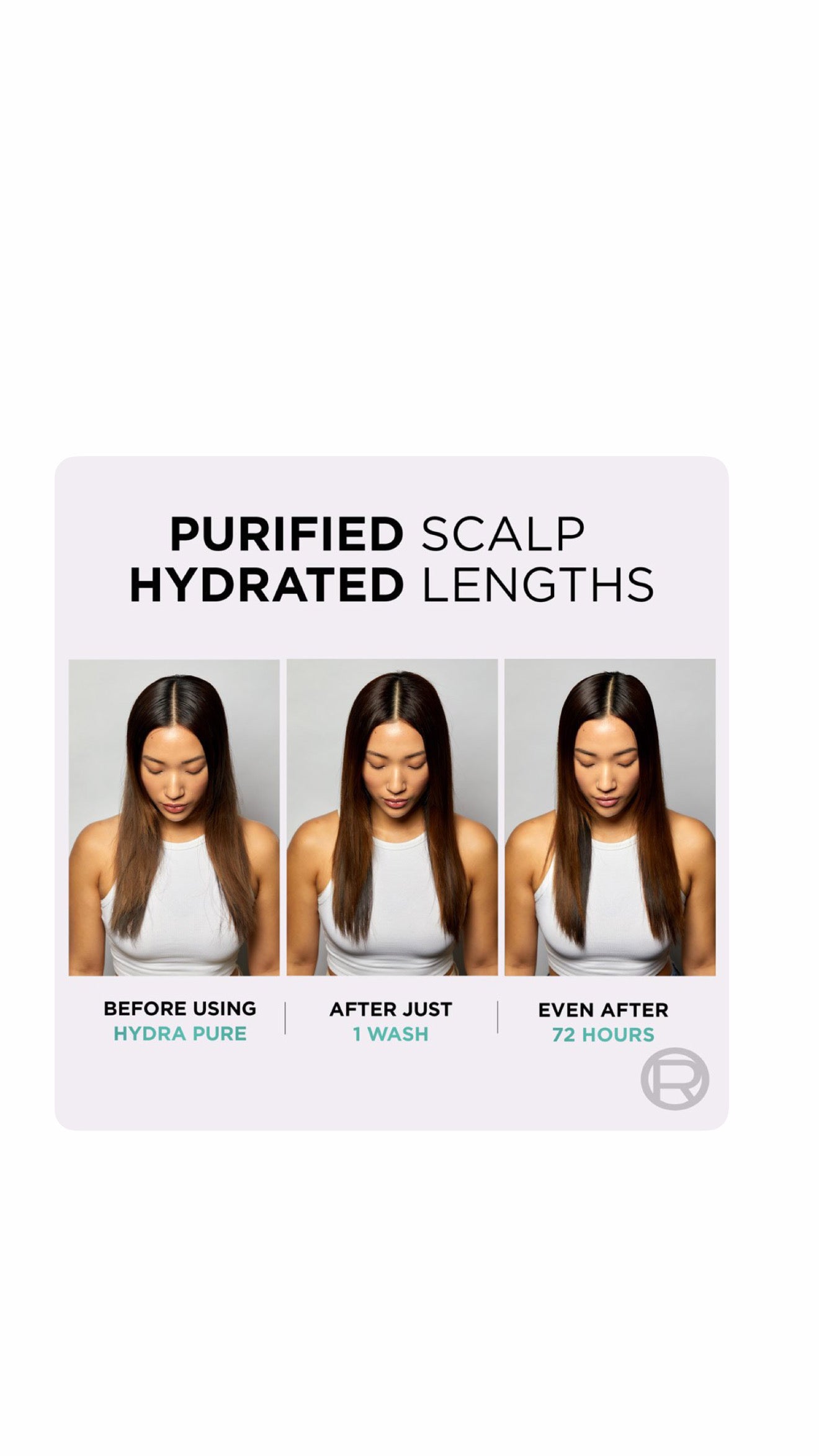 L’Oréal Paris Elvive Hydra Pure Exfoliating Pre-Shampoo Scalp Serum for Oily Scalp & Roots 102ml