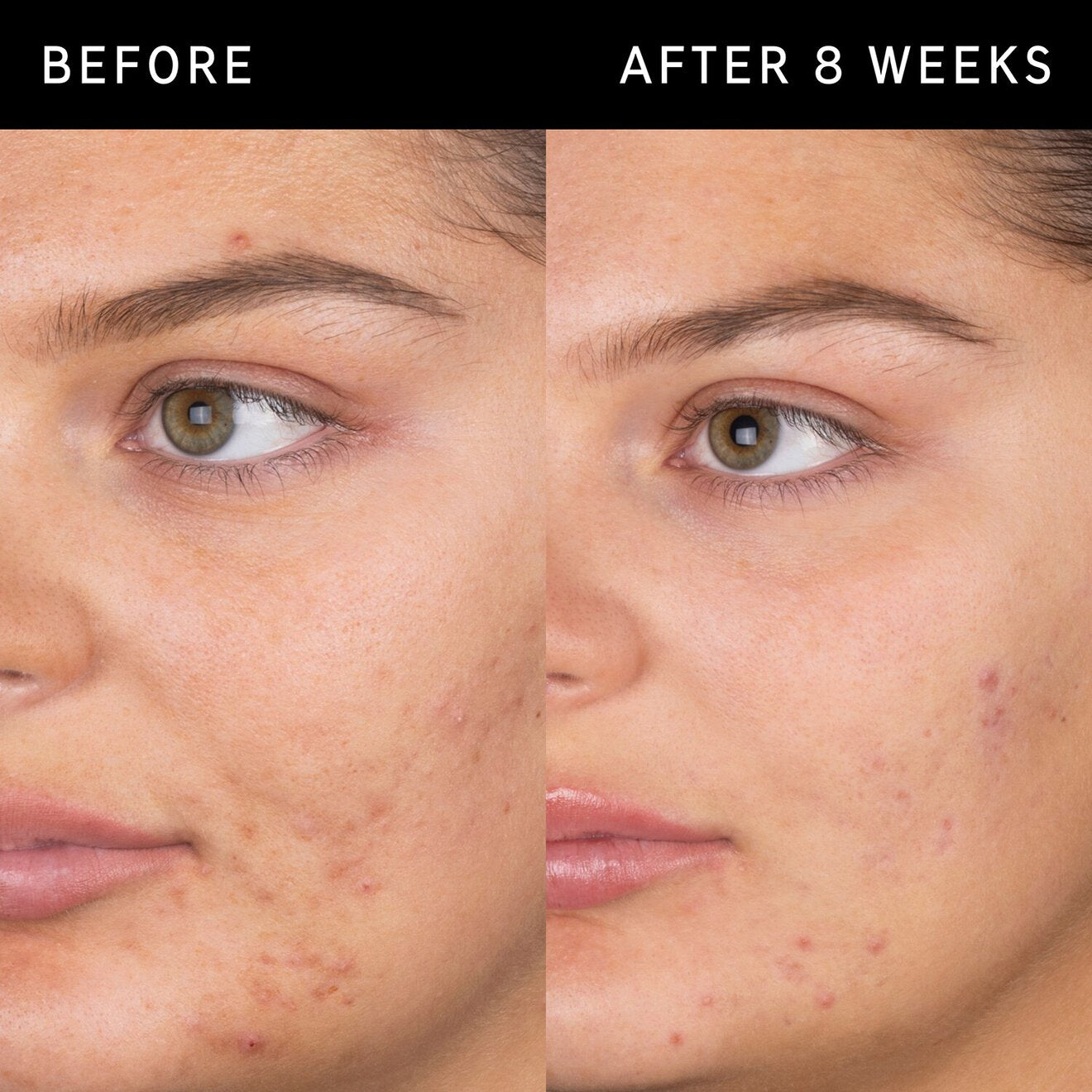 THE INKEY LIST Salicylic Acid Cleanser 150 ml