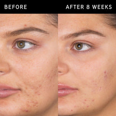 THE INKEY LIST Salicylic Acid Cleanser 150 ml