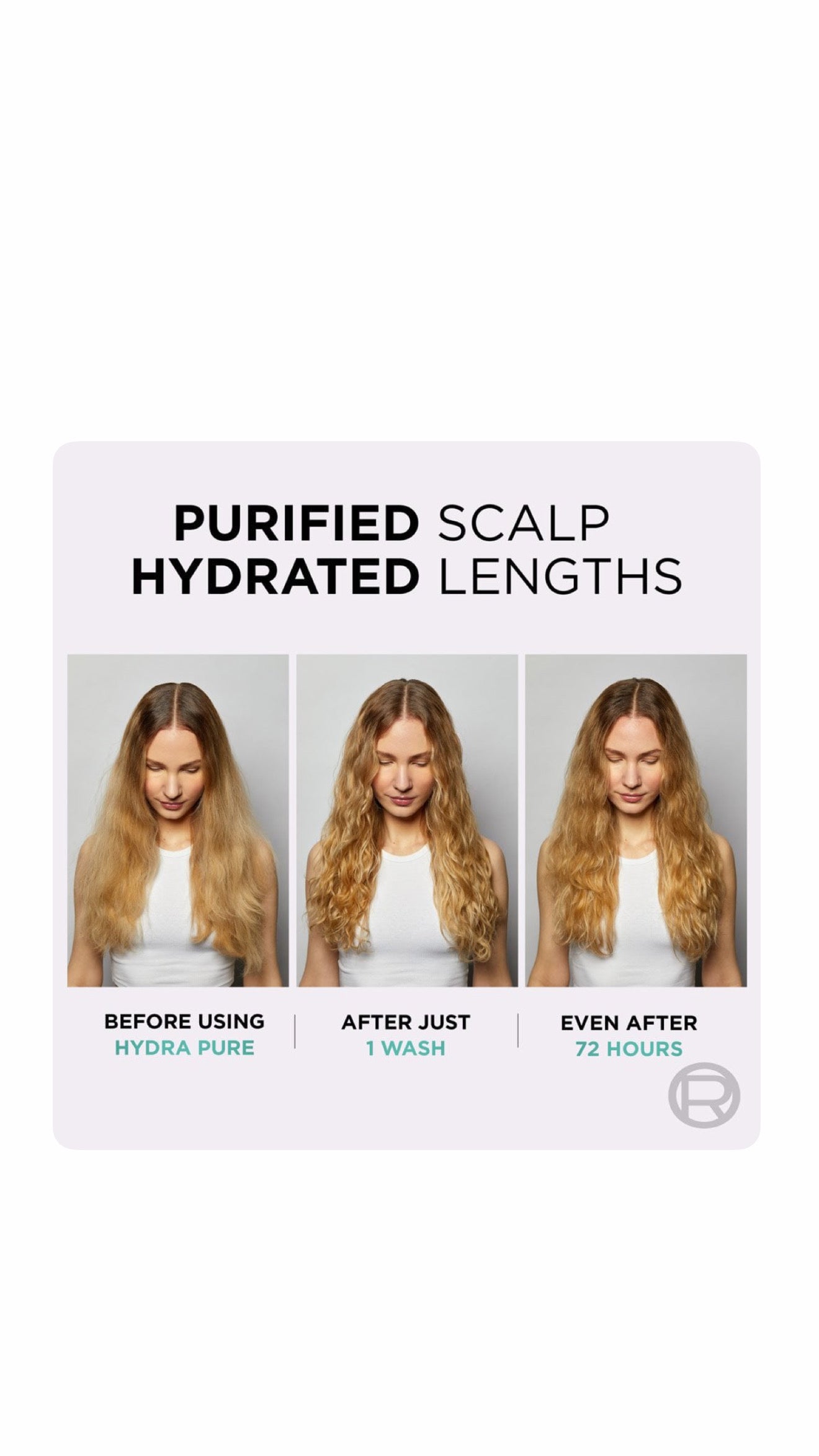L’Oréal Paris Elvive Hydra Pure Exfoliating Pre-Shampoo Scalp Serum for Oily Scalp & Roots 102ml